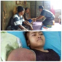 Cici Nurfida Penderita Tumor Ganas dan Kanker Tulang Terima Bantuan dari SPBU PT BBM